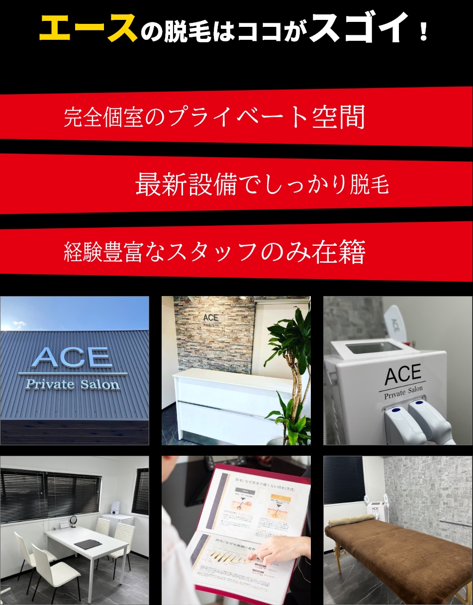 エースの脱毛はここがスゴイ